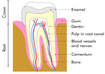 Atlanta Dentist tooth-cutout Atlanta Dentist Same Day Crowns